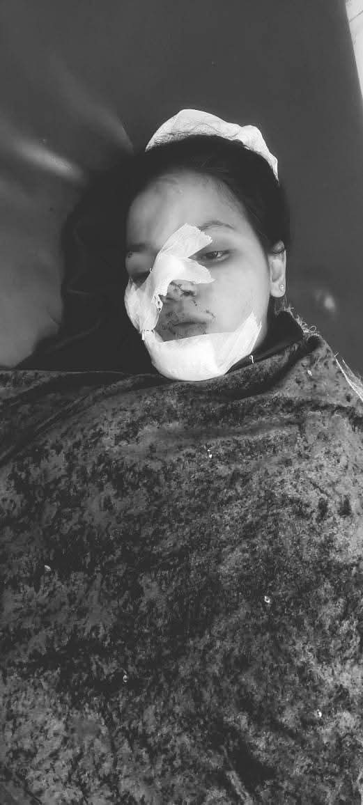 দাগনভূঞায় সিএনজি মুখোমুখি সংঘর্ষে নিহত ১ আহত ৬: