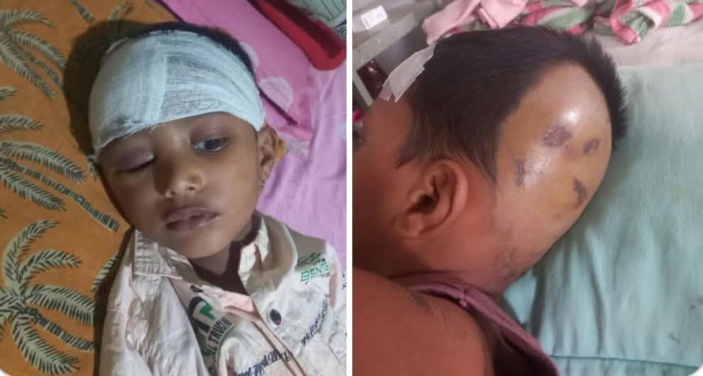 অর্থাভাবে বন্ধের উপক্রম চিকিৎসা, বাঁচতে চায় সাড়ে চার বছরের লাবিব